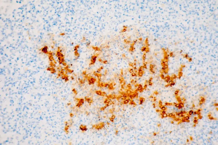 Representación microscópica de Aspergillus flavus